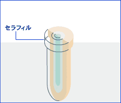 セラミックフィルターCerafil動画